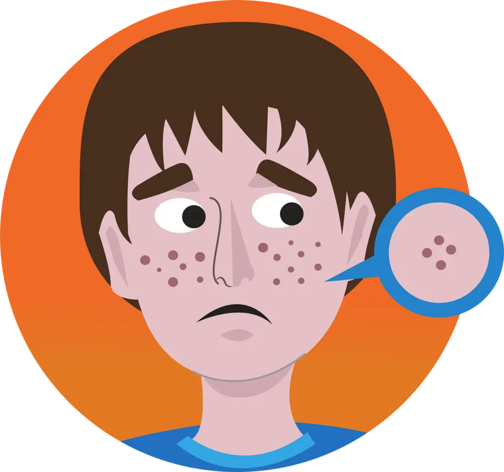 acne 4254911 1280