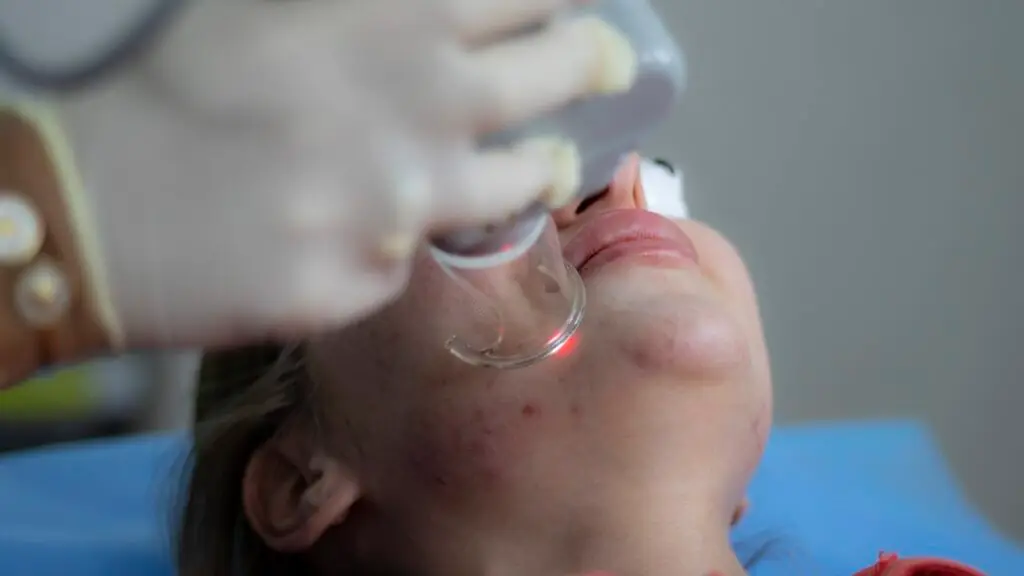 laser treatment 6664875 1280